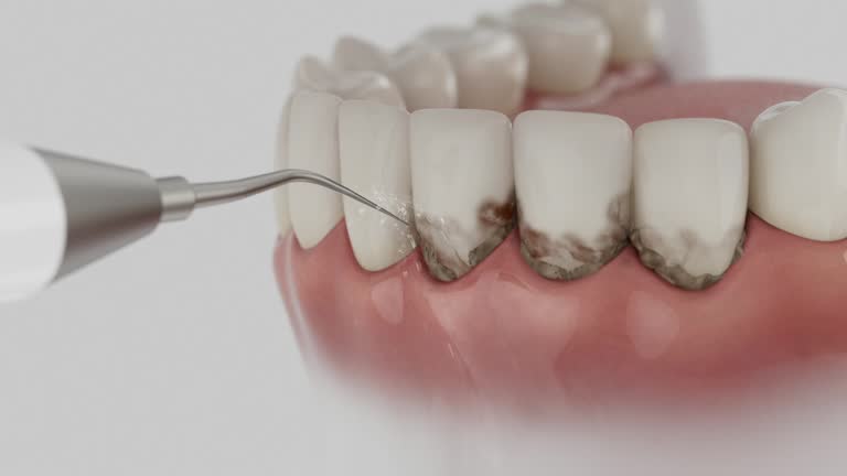 Trusted Dental Implants service in Clay, CA - Dentist Open Now